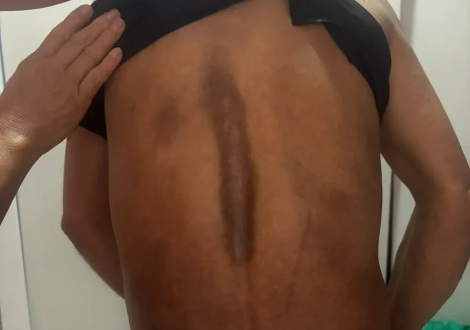Camisa de força e maus-tratos: brasileiros vão à Justiça contra ICE