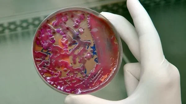 Cientistas identificam vírus no esgoto do Reino Unido que pode ser usado contra superbactéria